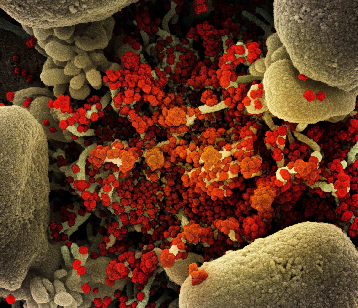 A lot remains a mystery about omicron, which has more than twice the number of mutations as the delta variant, with the bulk found in the spike, the crown-like protein on the surface of the virus that vaccines train our bodies to attack.  This colorized scanning electron micrograph of a cell heavily infected with SARS-CoV-2 virus particles (orange/red) was captured at the NIAID Integrated Research Facility (IRF) in 2020. (NIAID via ZUMA Wire/TNS)